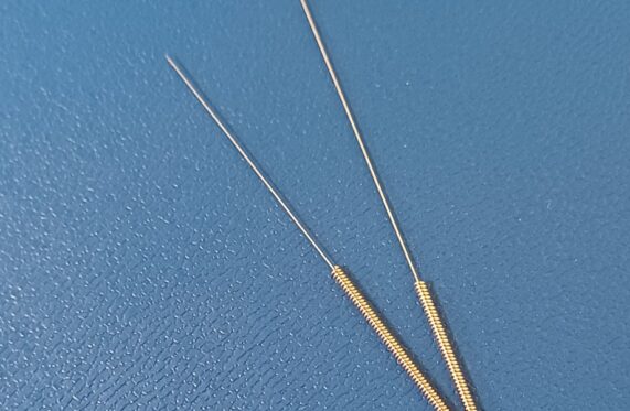 What Is Acupuncture and How Can It Help You?